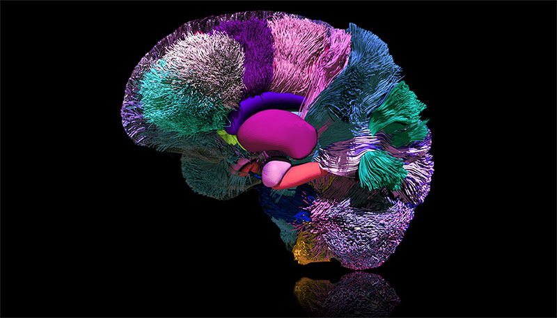 Multicolor image of reconstructed brain surfaces, deep gray matter structures and white matter tracts on a black background.