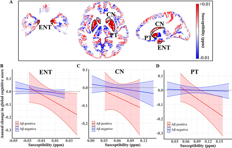Relationships among regional susceptibility, amyloid-β (Aβ) load, and annual changes in global cognitive scores. (A) Quantitative susceptibility maps show difference in gray matter regions in the Montreal Neurological Institute space, comparing group averages of the participants who were positive for Aβ versus negative for Aβ. Plots show associations between the baseline susceptibility values in the (B) entorhinal cortex (ENT), (C) caudate nucleus (CN), and (D) putamen (PT), and annual changes in the global cognitive score in participants with negative (blue) versus positive (red) global amyloid-β load.
