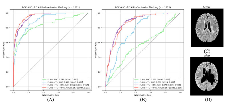 Receiver operating characteristic curves under FLAIR-only inference on the external test set, comparing models trained with sMRI=dMRI versus sMRI-only.