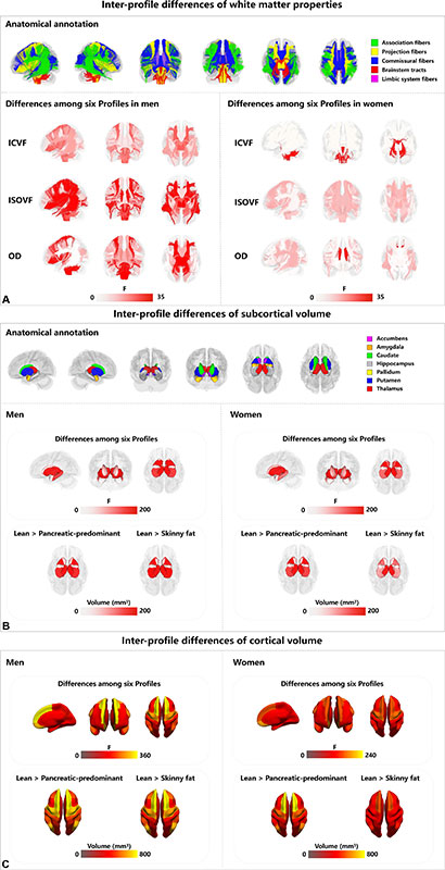 Group comparisons reveal differences across the six profiles in (A) brain white matter properties, (B) subcortical volume, and (C) cortical volume. 