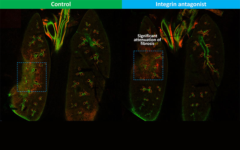 Whole organ optical tissue clearing with iDISCO and 3-D second harmonic generation (collagen) imaging at 8 weeks post-RT in the focal radiation-induced pulmonary fibrosis model, 
