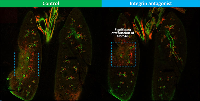 Whole organ optical tissue clearing with iDISCO and 3-D second harmonic generation (collagen) imaging at 8 weeks post-RT in the focal radiation-induced pulmonary fibrosis model, 