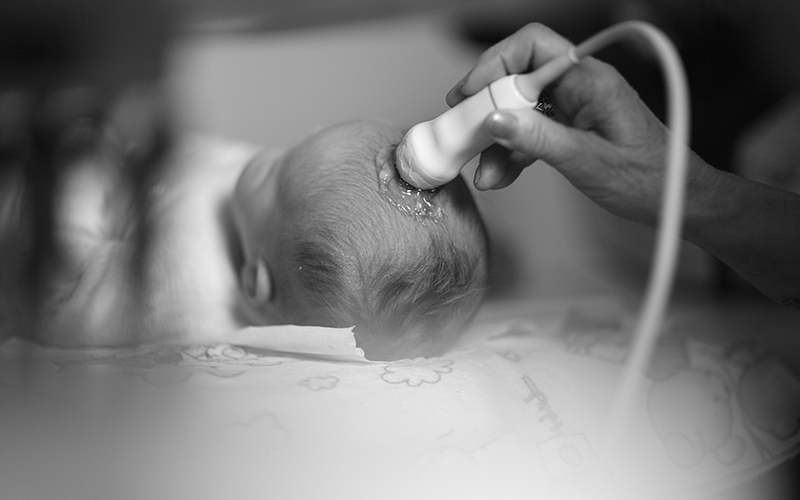 Black and white image of a newborn baby with an ultrasound wand being used to image its head