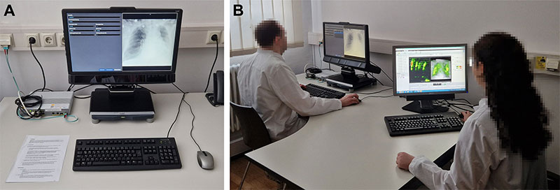 Technical setup for radiograph reporting under eye-tracking conditions. 