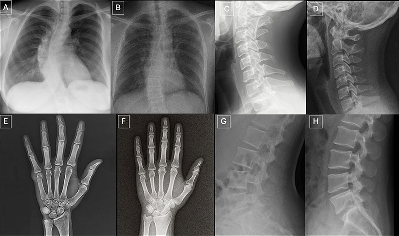Anatomy-matched real and GPT-4o-generated chest, hand, cervical spine and lumbar spine radiographs.