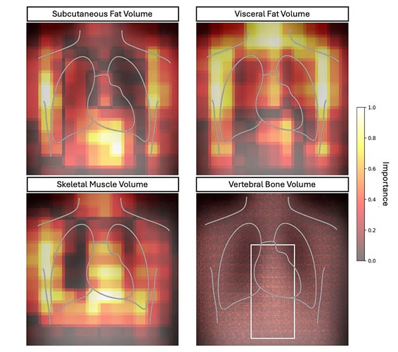 Saliency maps for feature importance in prediction of the top performing body composition metrics. 