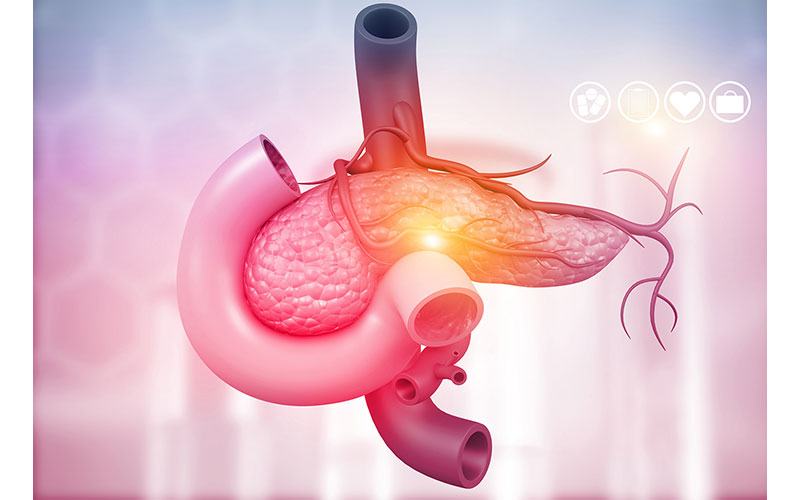 Illustration of the pancreas and stomach highlighting the inflammation in the pancreas, with surrounding digestive organs shown in soft pink and orange tones