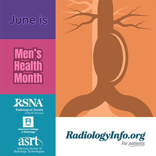 Graphic for Men’s Health Month with “June is Men’s Health Month,” partner organization logos, a stylized torso with blood vessels, and “RadiologyInfo.org – For patients.”