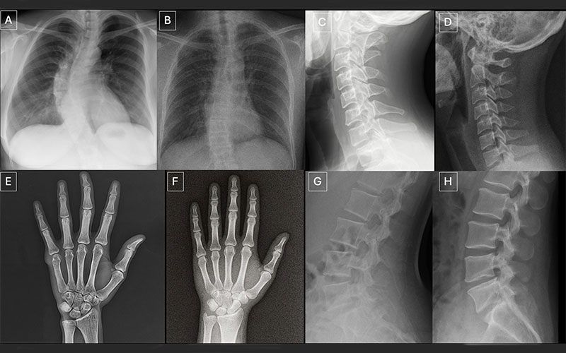 Lateraol Chest Radiograph 2026 Margulis Award | RSNA
