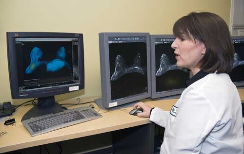 Breast MRI Photo of a radiologist viewing a breast MRI on a computer screen