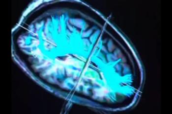 Press release video 3