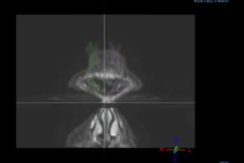 Press release video 4