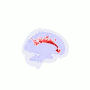 Press release video 1